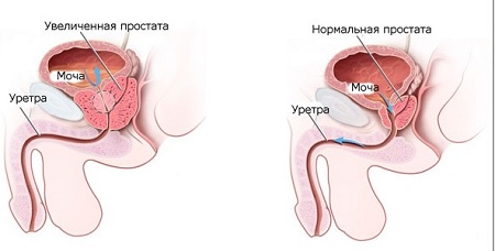 Прийом отоларинголога (тимчасово недоступно)