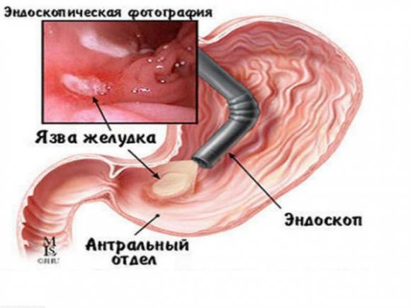 Консультація трихолога (повторна)