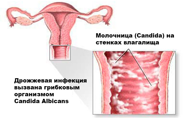 Консультація дитячого отоларинголога