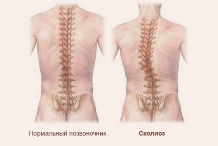 УЗД судин верхніх кінцівок